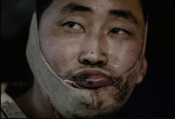 북한군 포로의 얼굴. 누구나 알아볼 수 있을 정도다/텔레그램 캡처